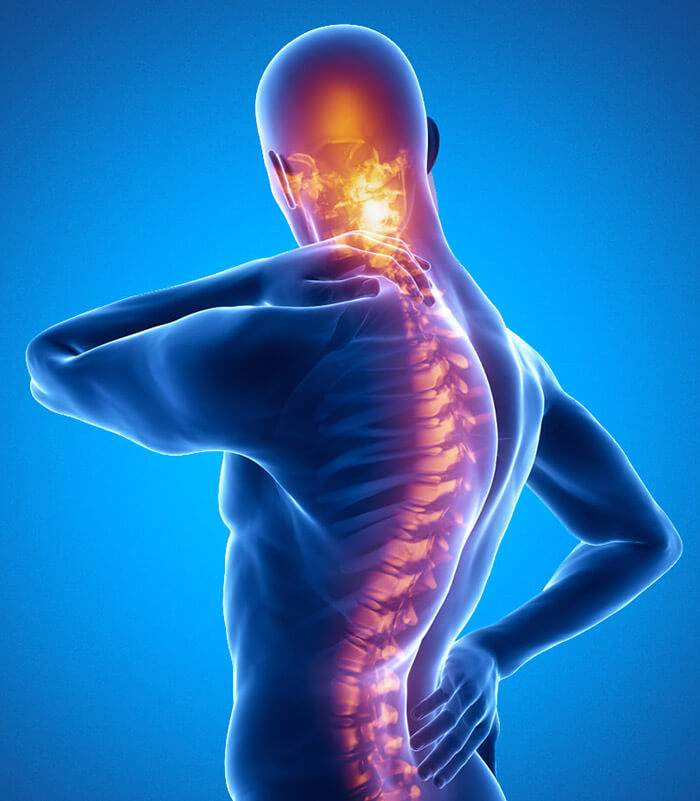 Ankylosing Spondylitis What Is It